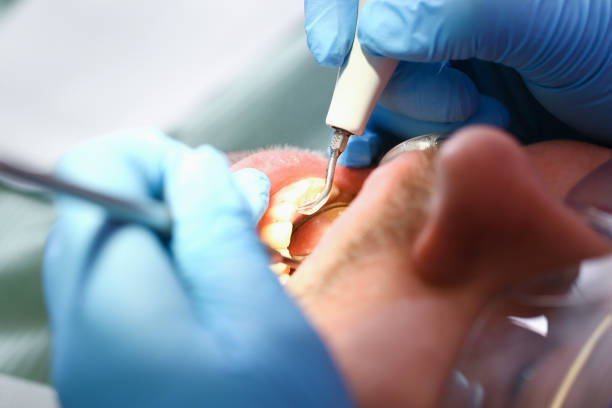 Best Emergency Root Canal Treatment in Cranford, NJ