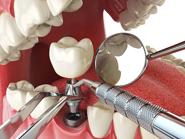 Best Emergency Dental Services for Seniors in Cranford, NJ